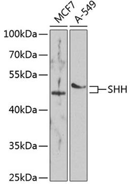 Western blot - SHH antibody (A7726)