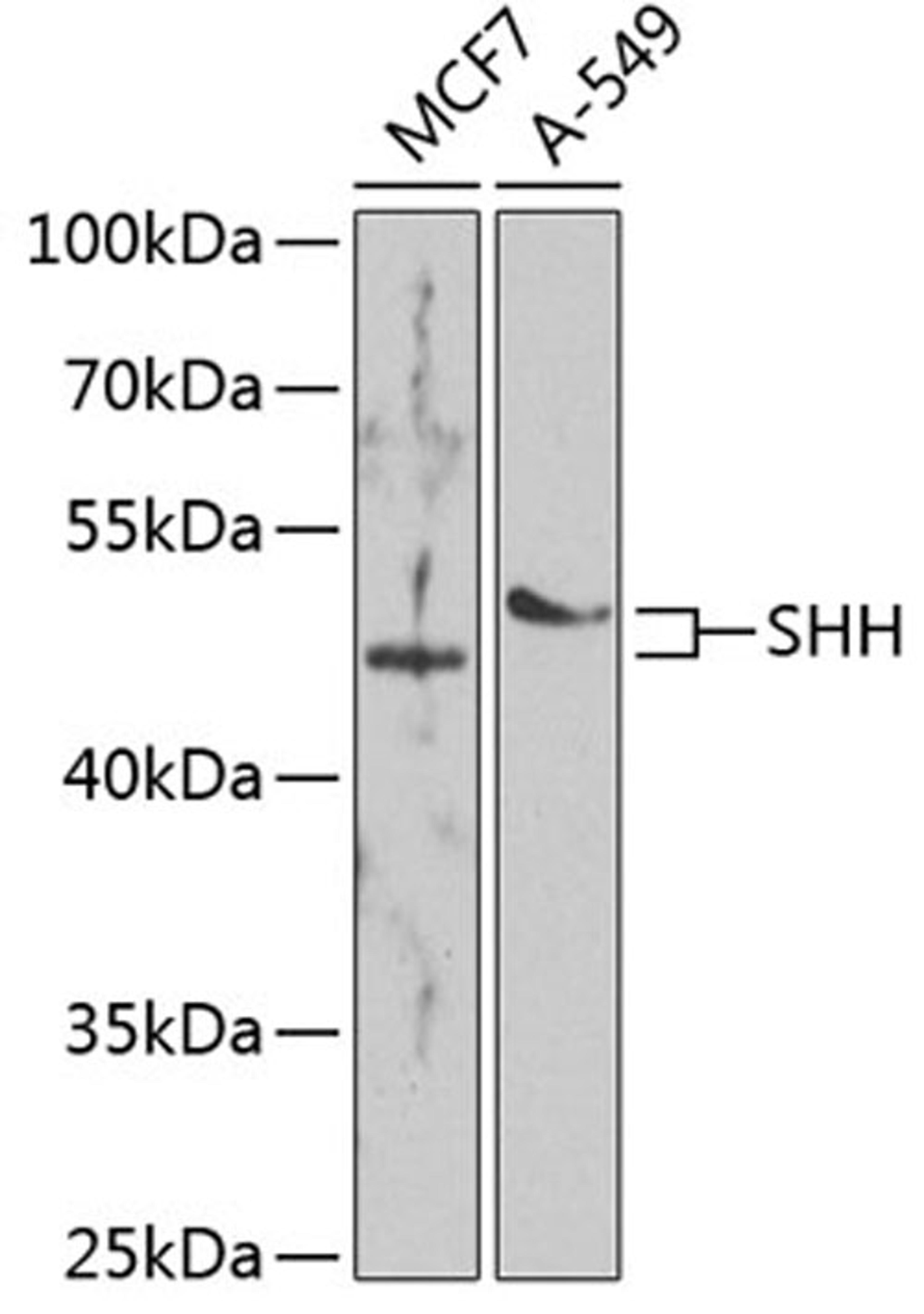 Western blot - SHH antibody (A7726)