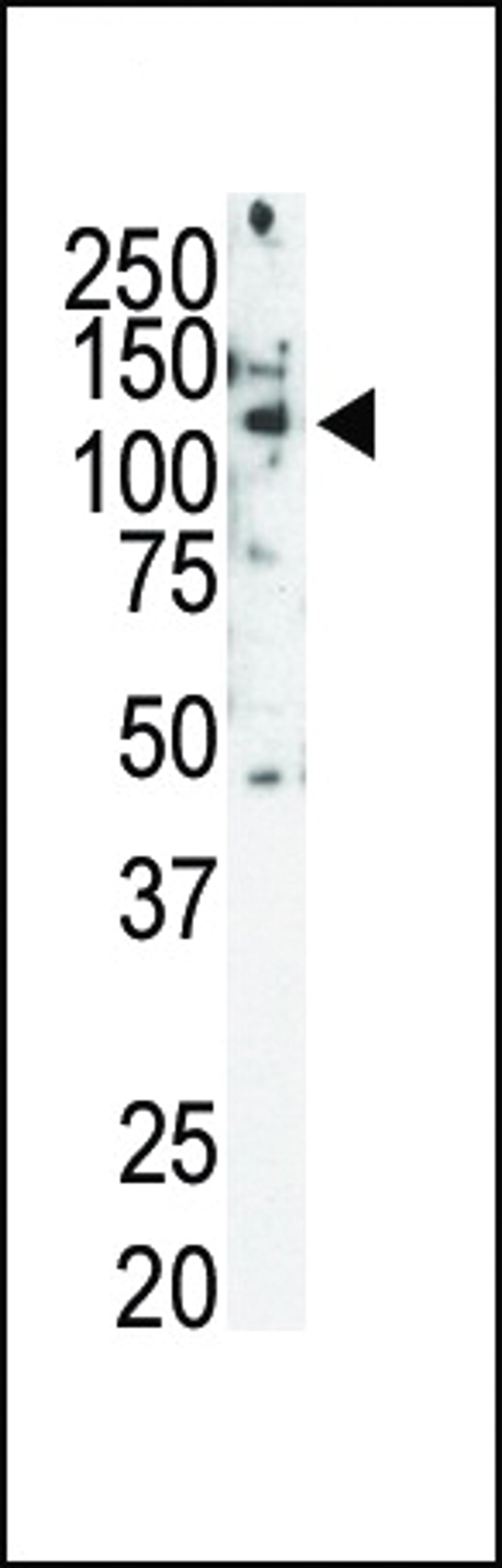 Western blot analysis of Ret Antibody (C-term T1078) in SKBR3 cell lysate