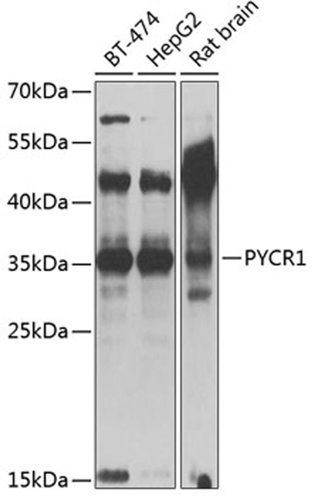 Western blot - PYCR1 antibody (A13346)