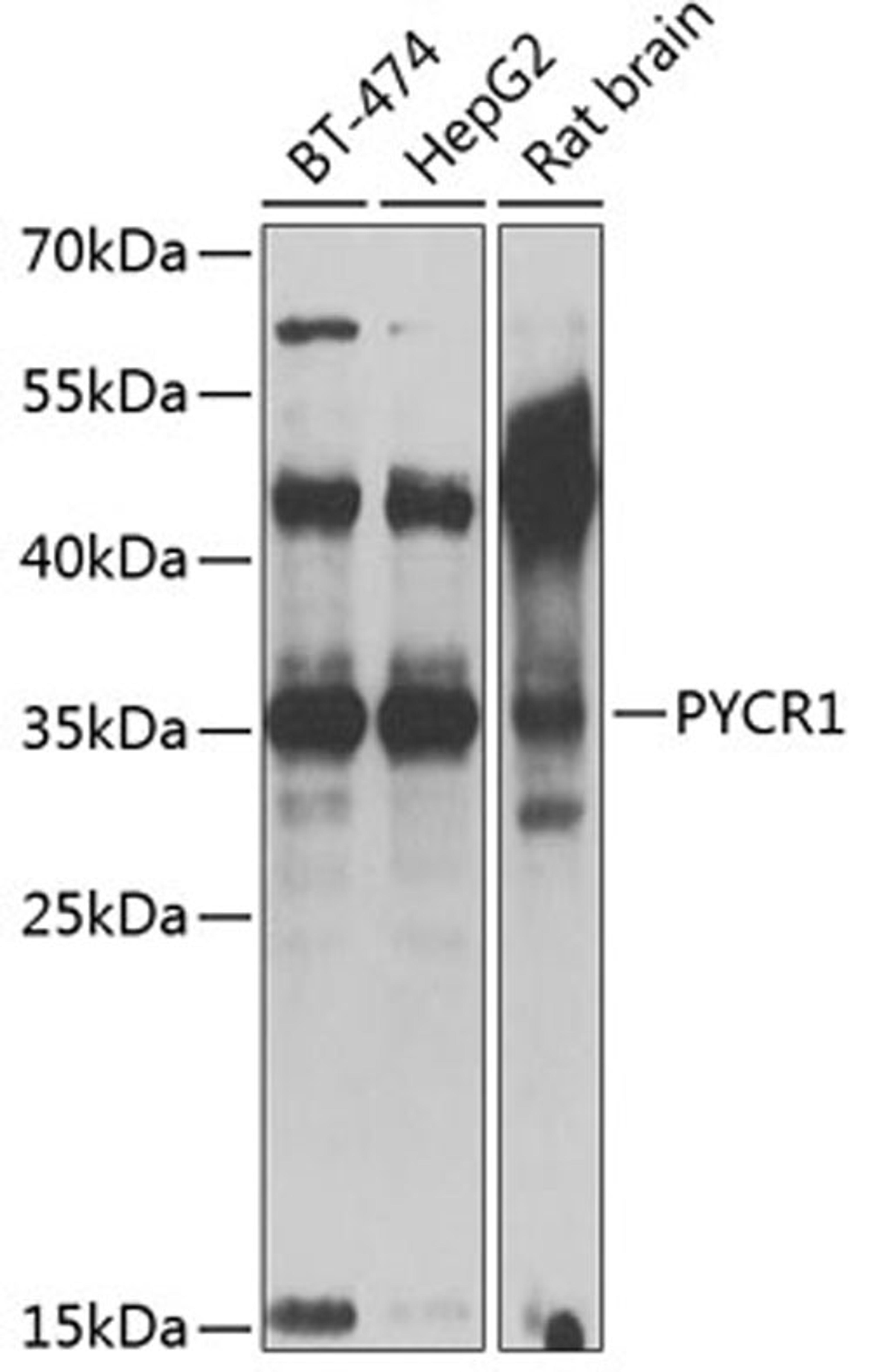 Western blot - PYCR1 antibody (A13346)