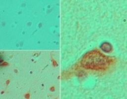 Immunohistochemistry-Paraffin: STELLAR Antibody [NBP2-27292] - Analysis of STELLAR in formalin-fixed, paraffin-embedded human brain tissue using an isotype control (top) and this antibody (bottom) at 5 ug/ml.