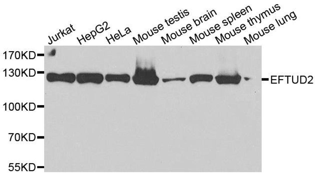 Western blot analysis of extracts of various cell lines using EFTUD2 antibody