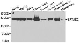 Western blot analysis of extracts of various cell lines using EFTUD2 antibody