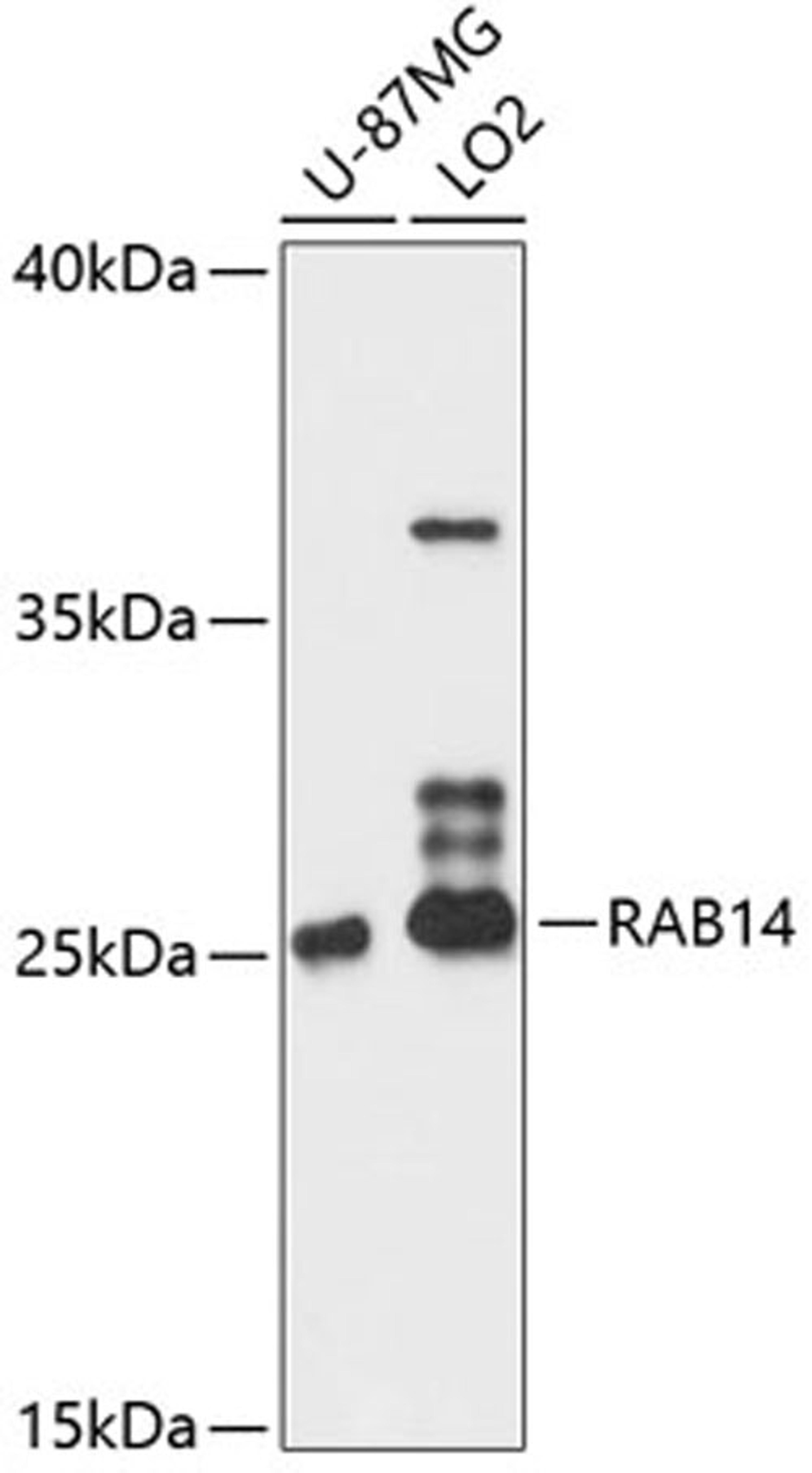 Western blot - RAB14 antibody (A12752)