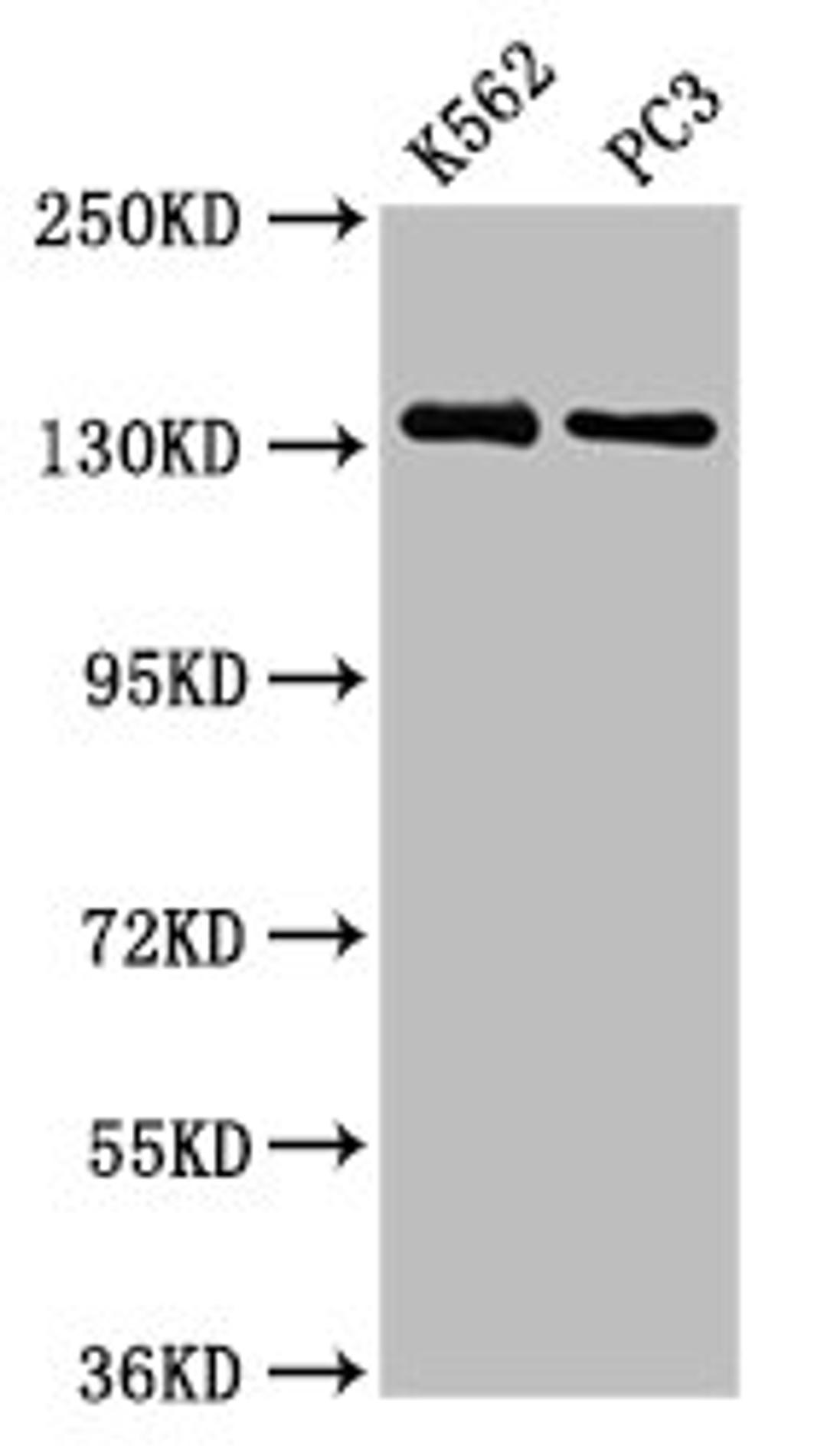 Western Blot. Positive WB detected in: K562 whole cell lysate, PC-3 whole cell lysate. All lanes: NRDC antibody at 3.73µg/ml. Secondary. Goat polyclonal to rabbit IgG at 1/50000 dilution. Predicted band size: 132, 140 kDa. Observed band size: 132 kDa