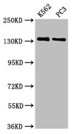 Western Blot. Positive WB detected in: K562 whole cell lysate, PC-3 whole cell lysate. All lanes: NRDC antibody at 3.73µg/ml. Secondary. Goat polyclonal to rabbit IgG at 1/50000 dilution. Predicted band size: 132, 140 kDa. Observed band size: 132 kDa
