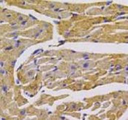 Immunoistochemical staining of mouse heart tissue using VEGFR1 antibody