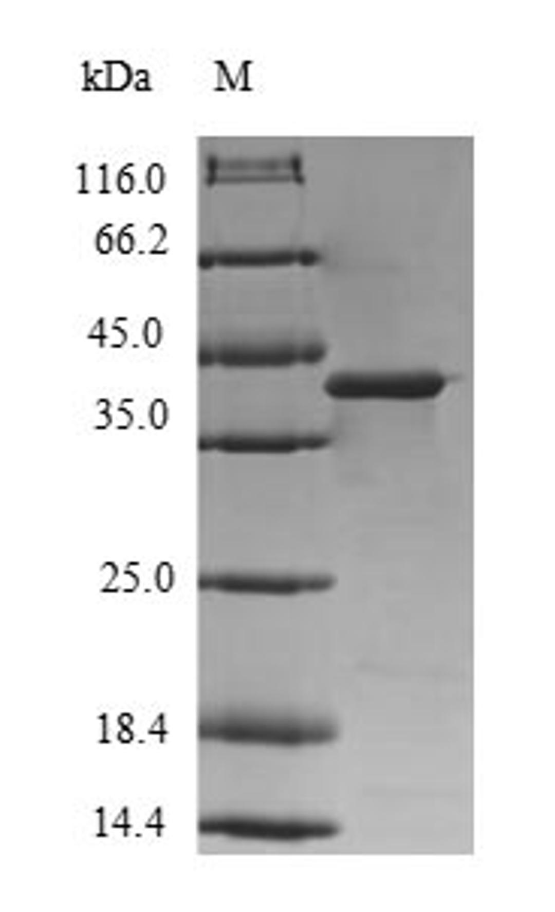 (Tris-Glycine gel) Discontinuous SDS-PAGE (reduced) with 5% enrichment gel and 15% separation gel.