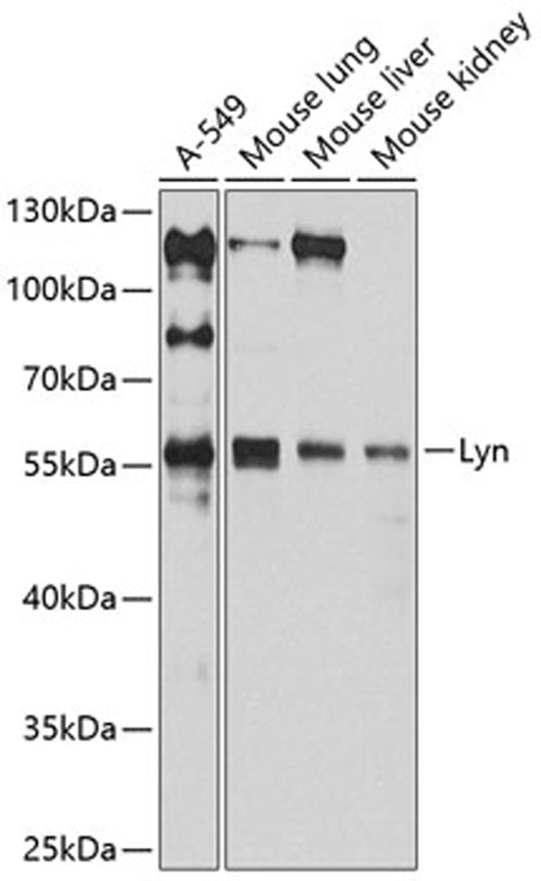 Western blot - Lyn antibody (A11385)