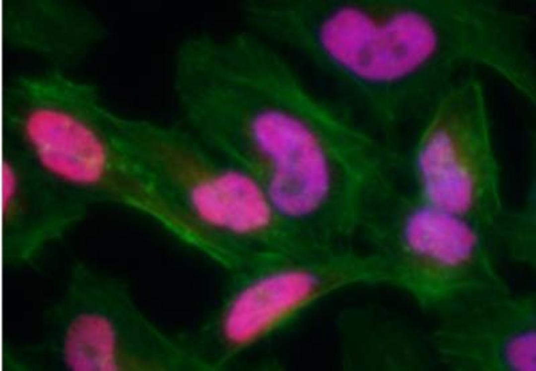 Immunocytochemistry/Immunofluorescence: gamma H2AX [p Ser139] Antibody [NB100-2280] - Neocarzinostatin treated asynchronous HeLa cells. Affinity  purified rabbit anti-gamma-H2AX used at a dilution of 1:100. Detection: Red fluorescent  Anti rabbit IgG-DyLight (r) 594 conjugated used at a dilution of 1:100.