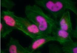 Immunocytochemistry/Immunofluorescence: gamma H2AX [p Ser139] Antibody [NB100-2280] - Neocarzinostatin treated asynchronous HeLa cells. Affinity  purified rabbit anti-gamma-H2AX used at a dilution of 1:100. Detection: Red fluorescent  Anti rabbit IgG-DyLight (r) 594 conjugated used at a dilution of 1:100.