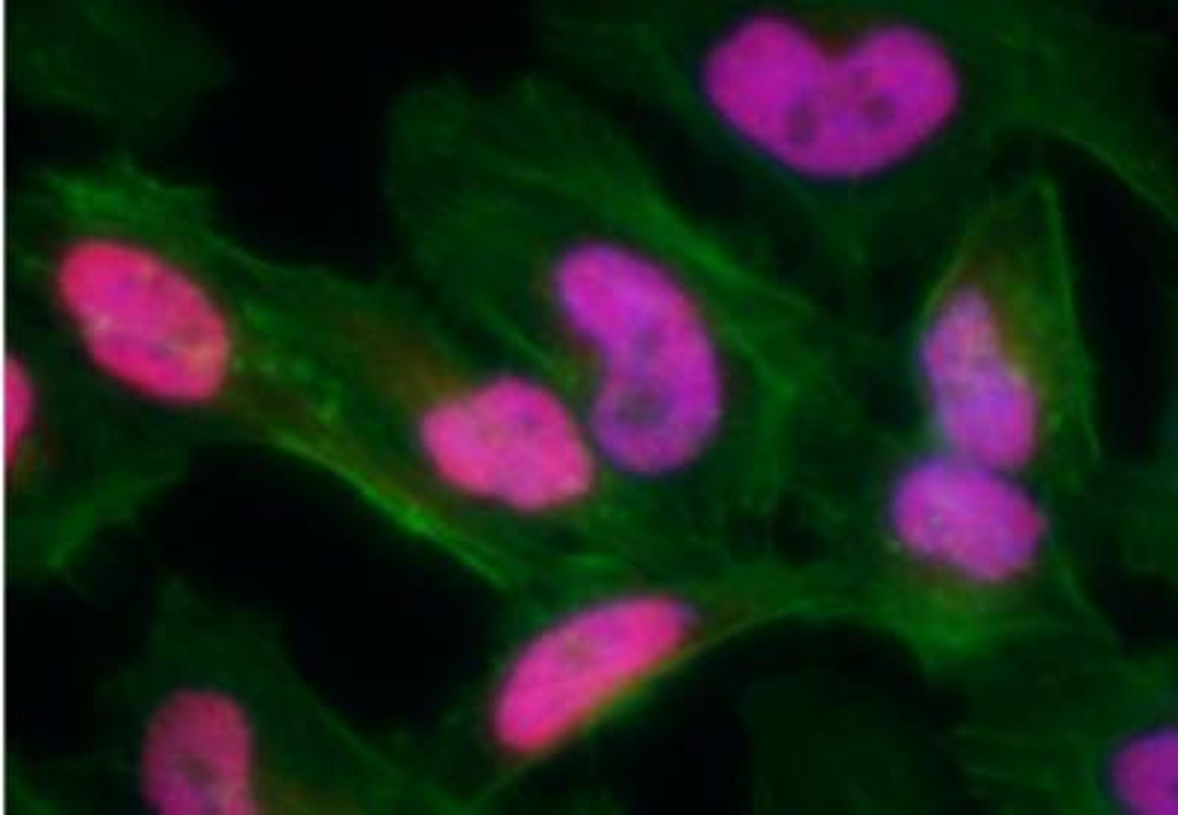 Immunocytochemistry/Immunofluorescence: gamma H2AX [p Ser139] Antibody [NB100-2280] - Neocarzinostatin treated asynchronous HeLa cells. Affinity  purified rabbit anti-gamma-H2AX used at a dilution of 1:100. Detection: Red fluorescent  Anti rabbit IgG-DyLight (r) 594 conjugated used at a dilution of 1:100.