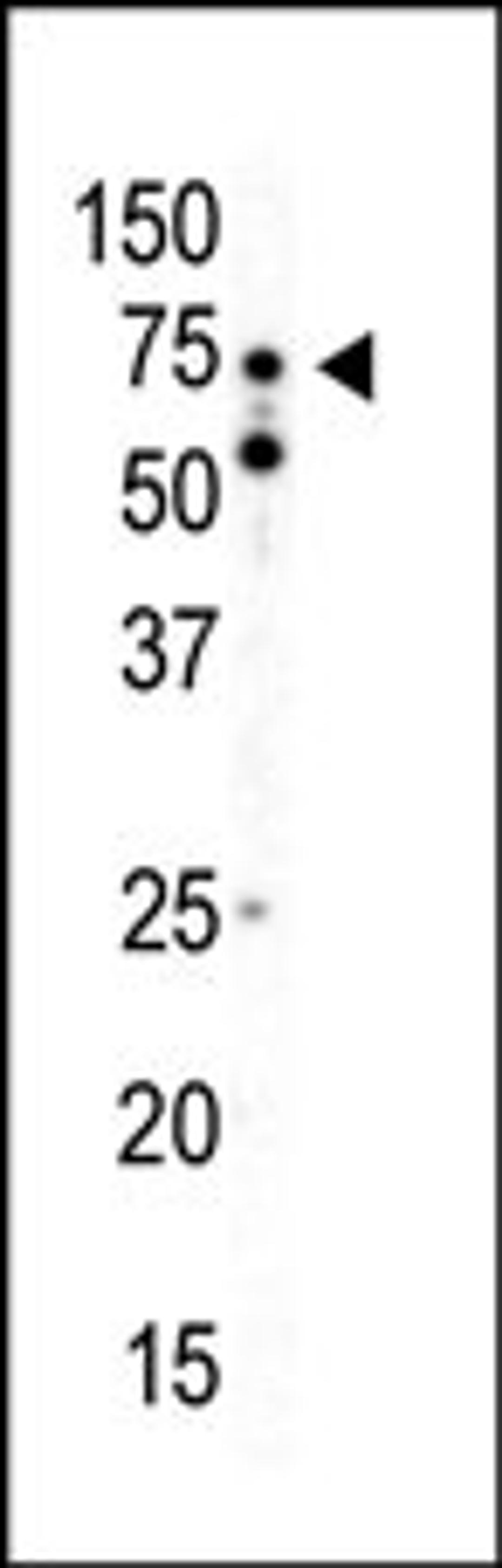 Western blot analysis of anti-AMPK alpha2 C-term Pab in mouse heart tissue lysate. AMPK alpha2 was detected using purified Pab.