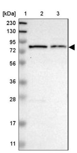 Western Blot: Myotubularin Antibody [NBP1-86113] - Lane 1: Marker [kDa] 230, 130, 95, 72, 56, 36, 28, 17, 11<br/>Lane 2: Human cell line RT-4<br/>Lane 3: Human cell line U-251MG sp