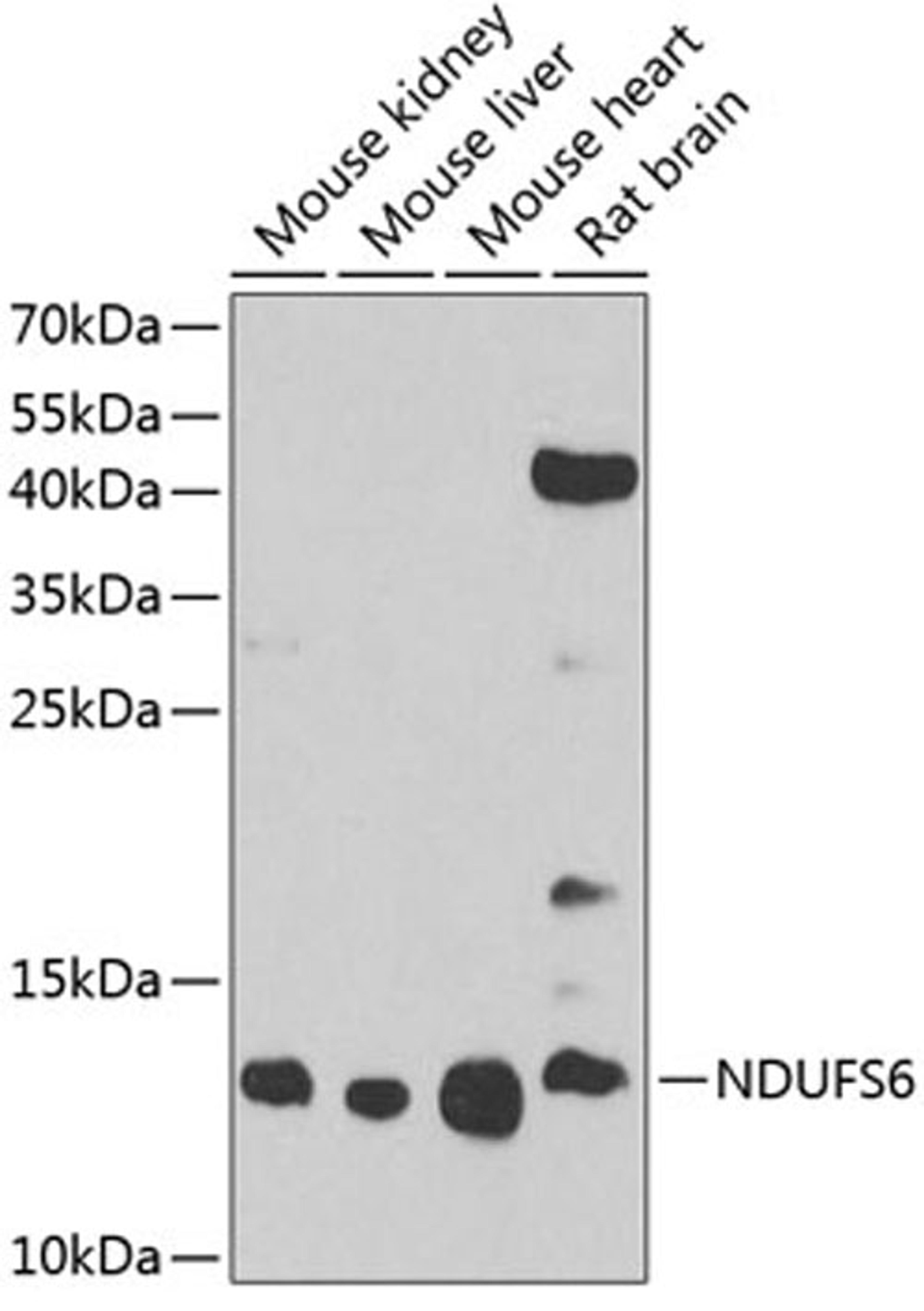 Western blot - NDUFS6 antibody (A3985)