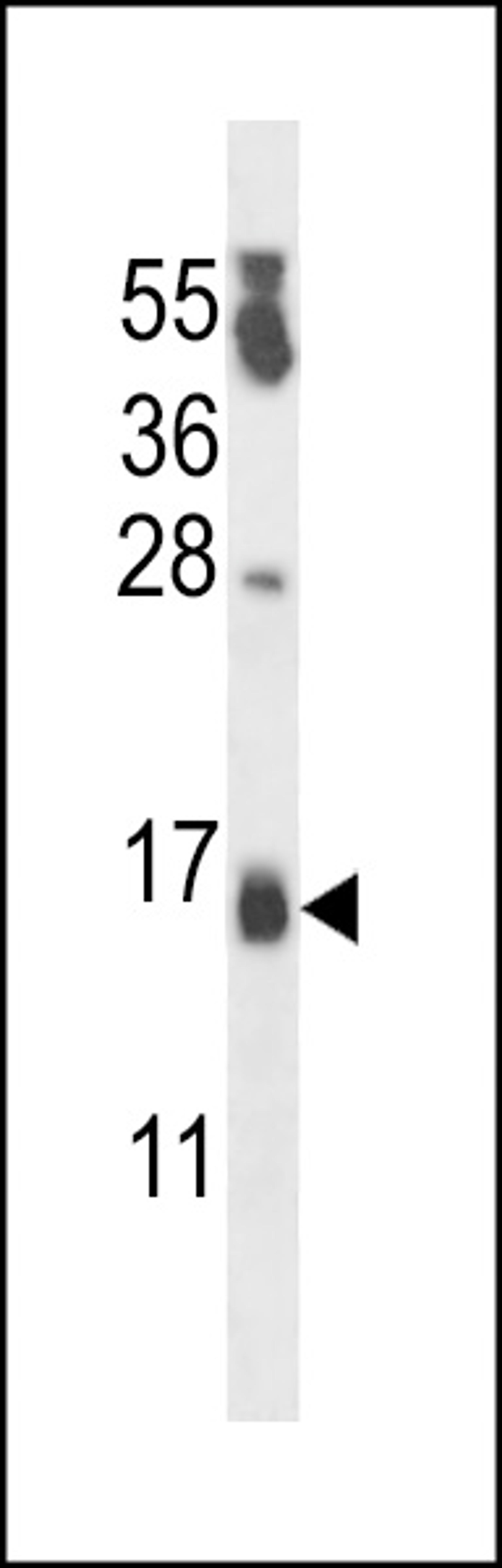 Western blot analysis in MDA-MB231 cell line lysates (35ug/lane).