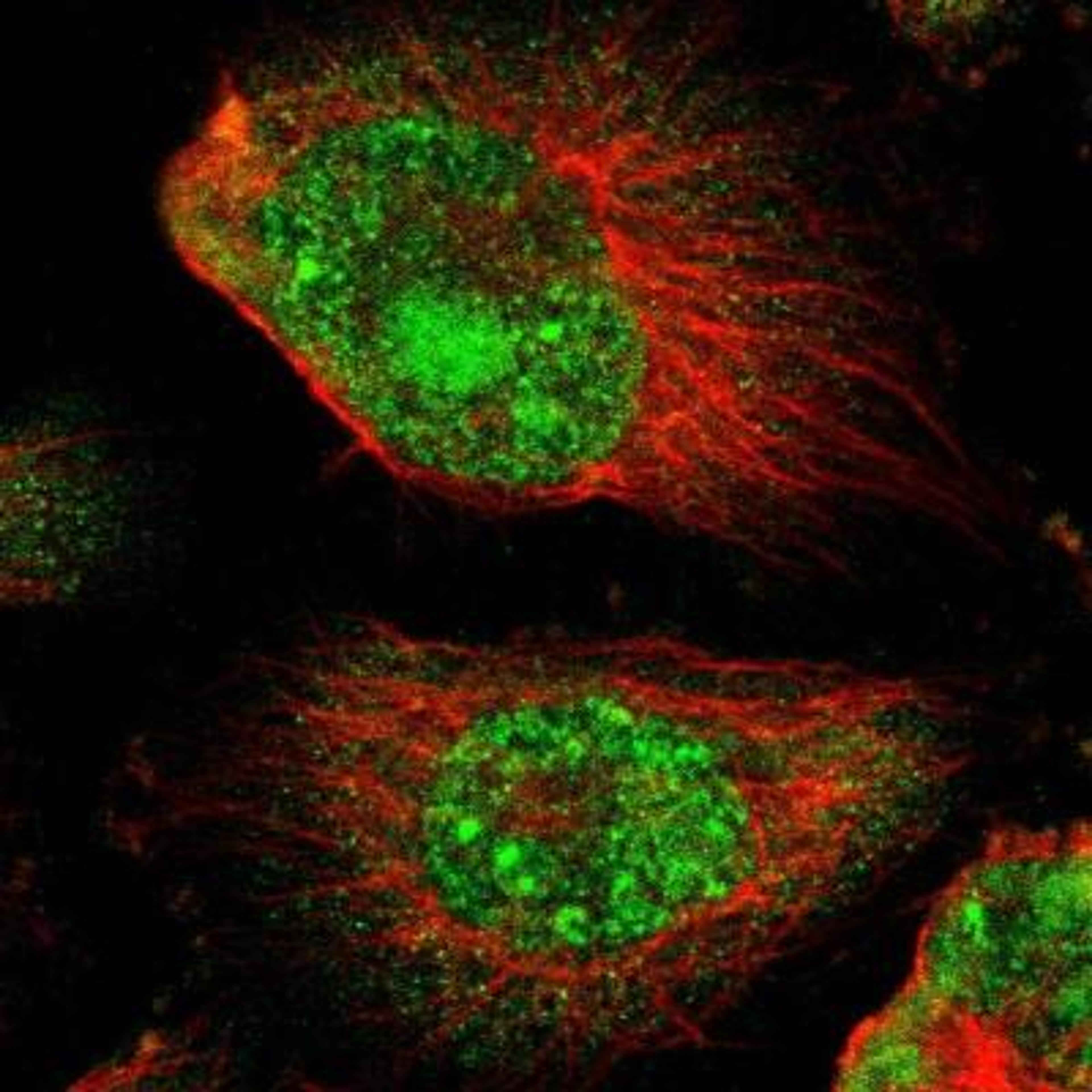 Immunocytochemistry/Immunofluorescence: LRP-4 Antibody [NBP1-81240] - Staining of human cell line U-251MG shows positivity in nucleus, nucleoli & cytoplasm.