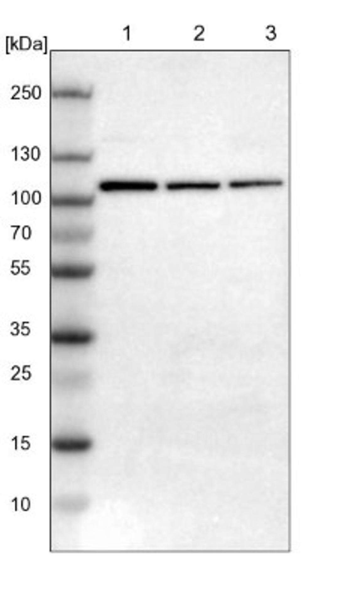 Western Blot: AK7 Antibody [NBP1-83515] - Lane 1: NIH-3T3 cell lysate (Mouse embryonic fibroblast cells)<br/>Lane 2: NBT-II cell lysate (Rat Wistar bladder tumour cells)<br/>Lane 3: PC12 cell lysate (Pheochromocytoma of rat adrenal medulla)