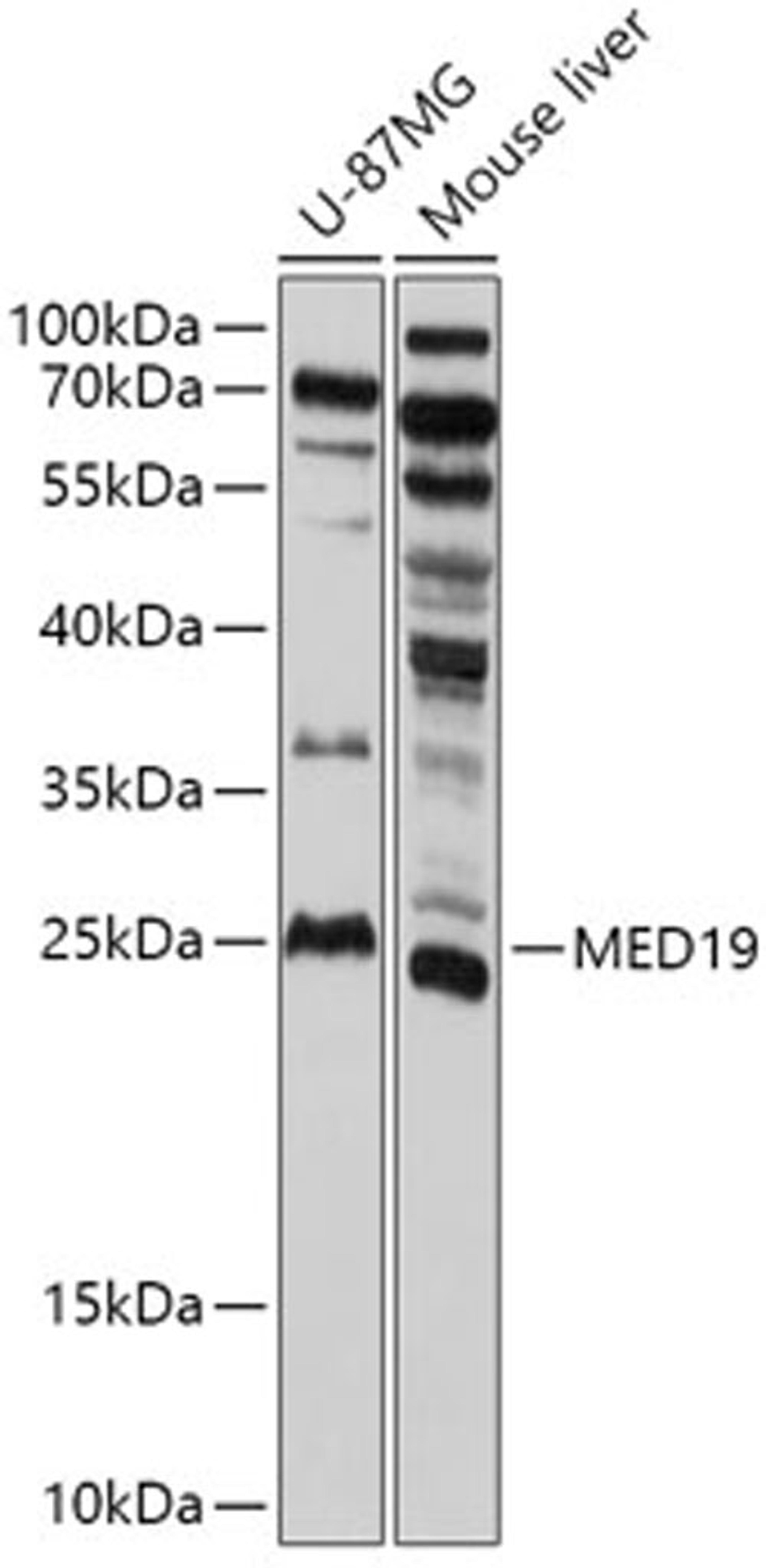 Western blot - MED19 antibody (A17844)