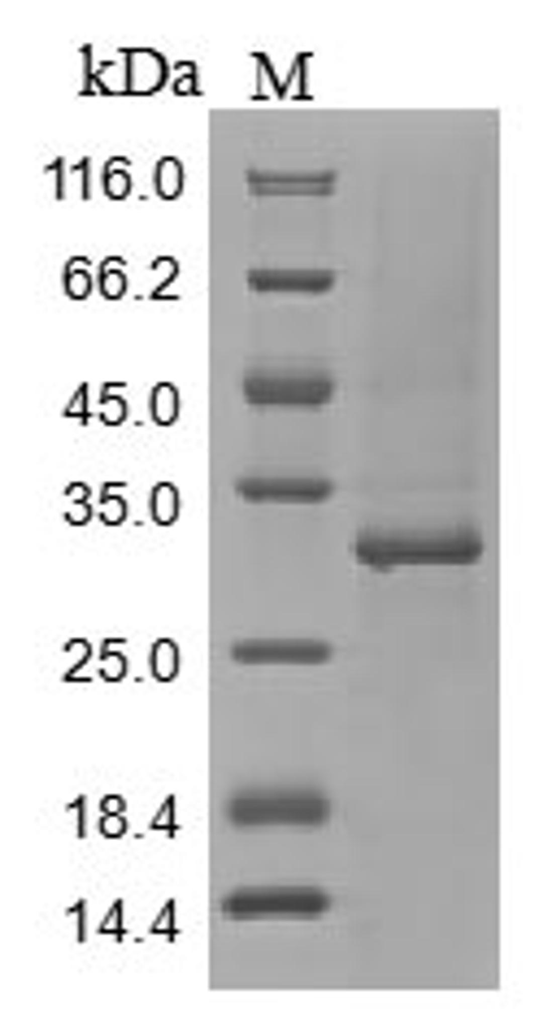 (Tris-Glycine gel) Discontinuous SDS-PAGE (reduced) with 5% enrichment gel and 15% separation gel.