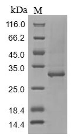 (Tris-Glycine gel) Discontinuous SDS-PAGE (reduced) with 5% enrichment gel and 15% separation gel.