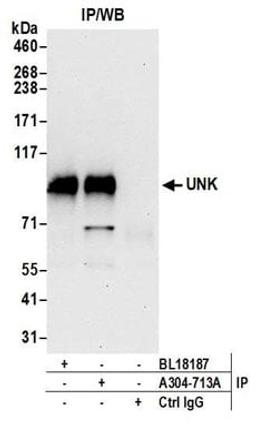 Detection of human UNK by western blot of immunoprecipitates.