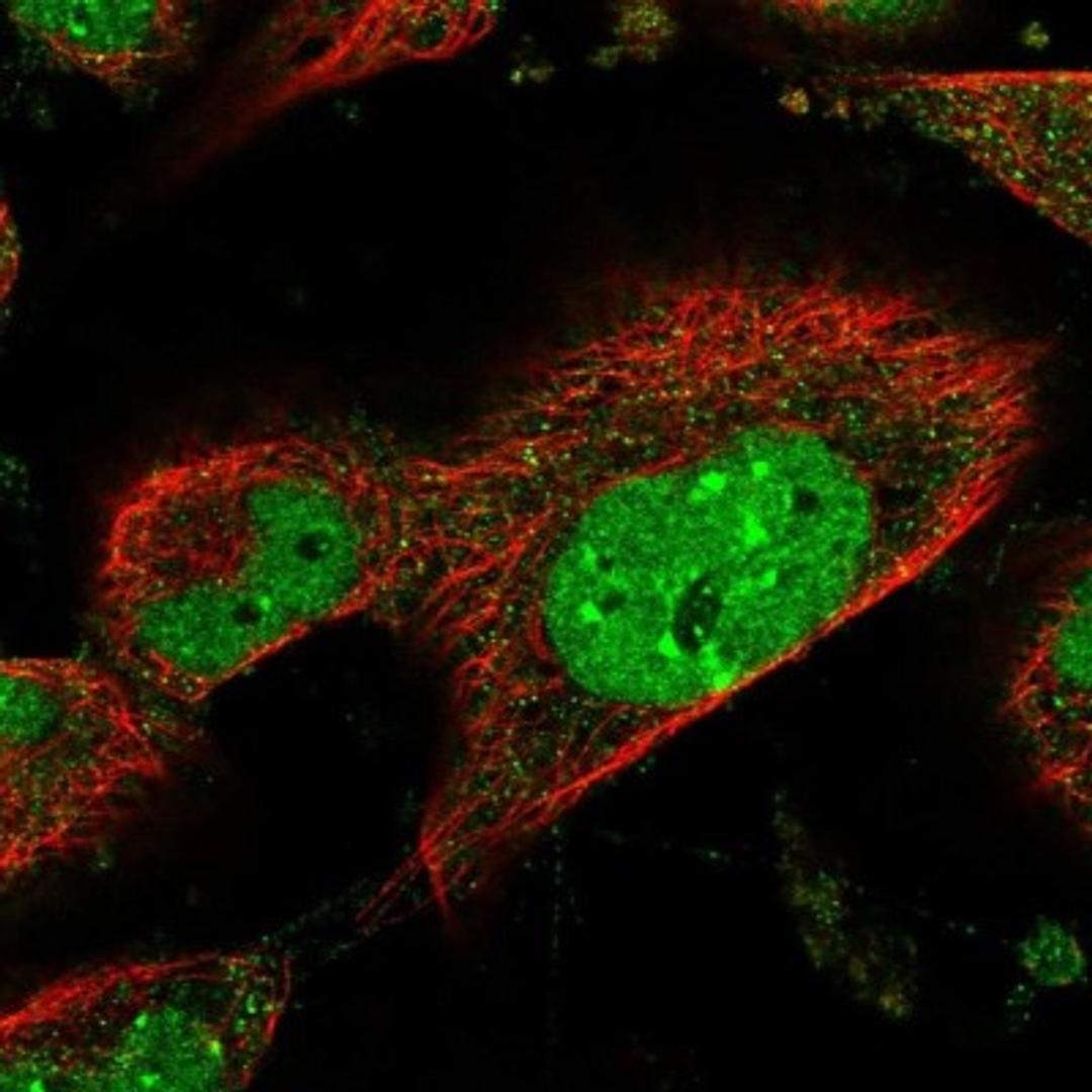 Immunocytochemistry/Immunofluorescence: SMCHD1 Antibody [NBP1-82978] - Staining of human cell line U-251 MG shows positivity in nucleus but not nucleoli.