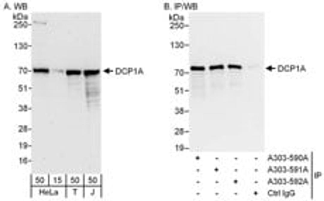 Detection of human DCP1A by western blot and immunoprecipitation.