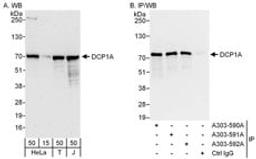 Detection of human DCP1A by western blot and immunoprecipitation.