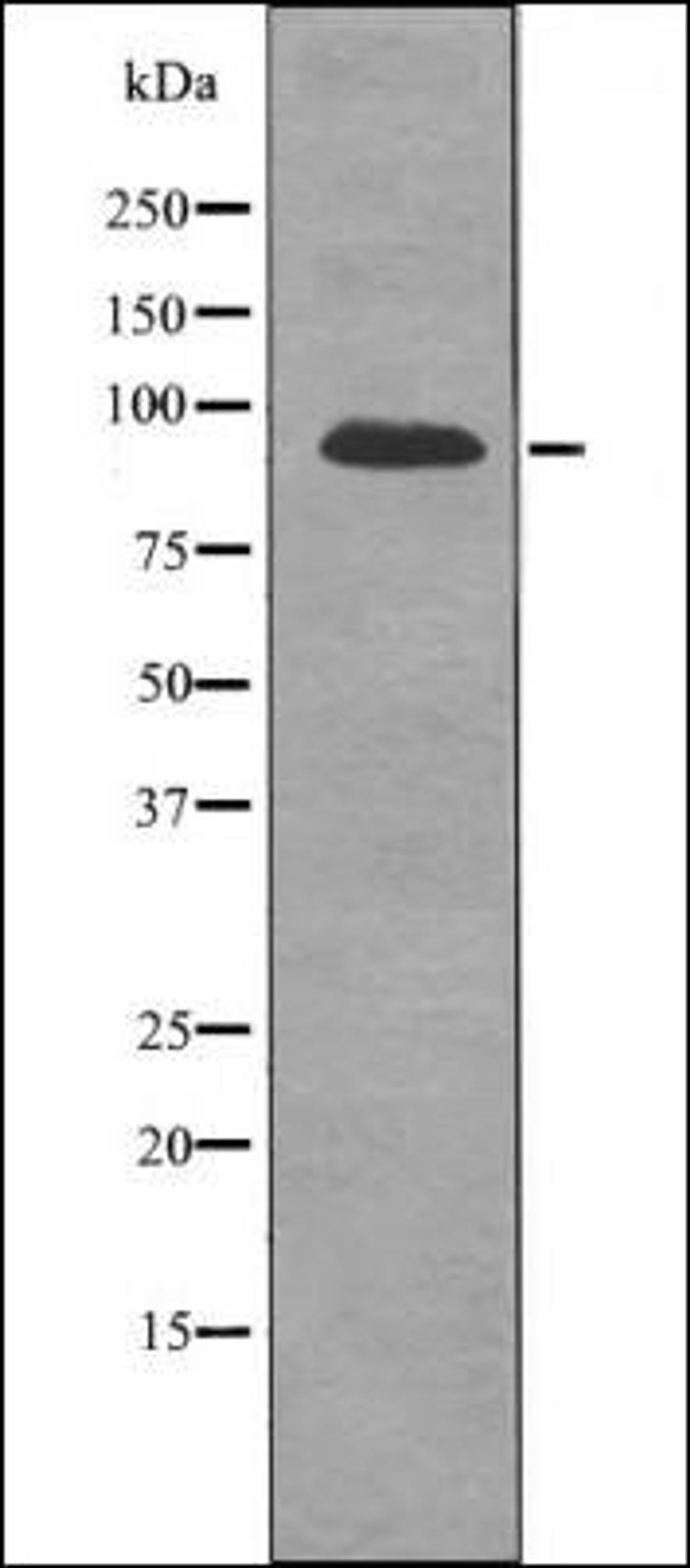 Western blot analysis of PC12 whole cell lysates using FGFR2 -Phospho-Ser782- antibody