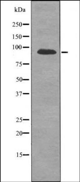 Western blot analysis of PC12 whole cell lysates using FGFR2 -Phospho-Ser782- antibody