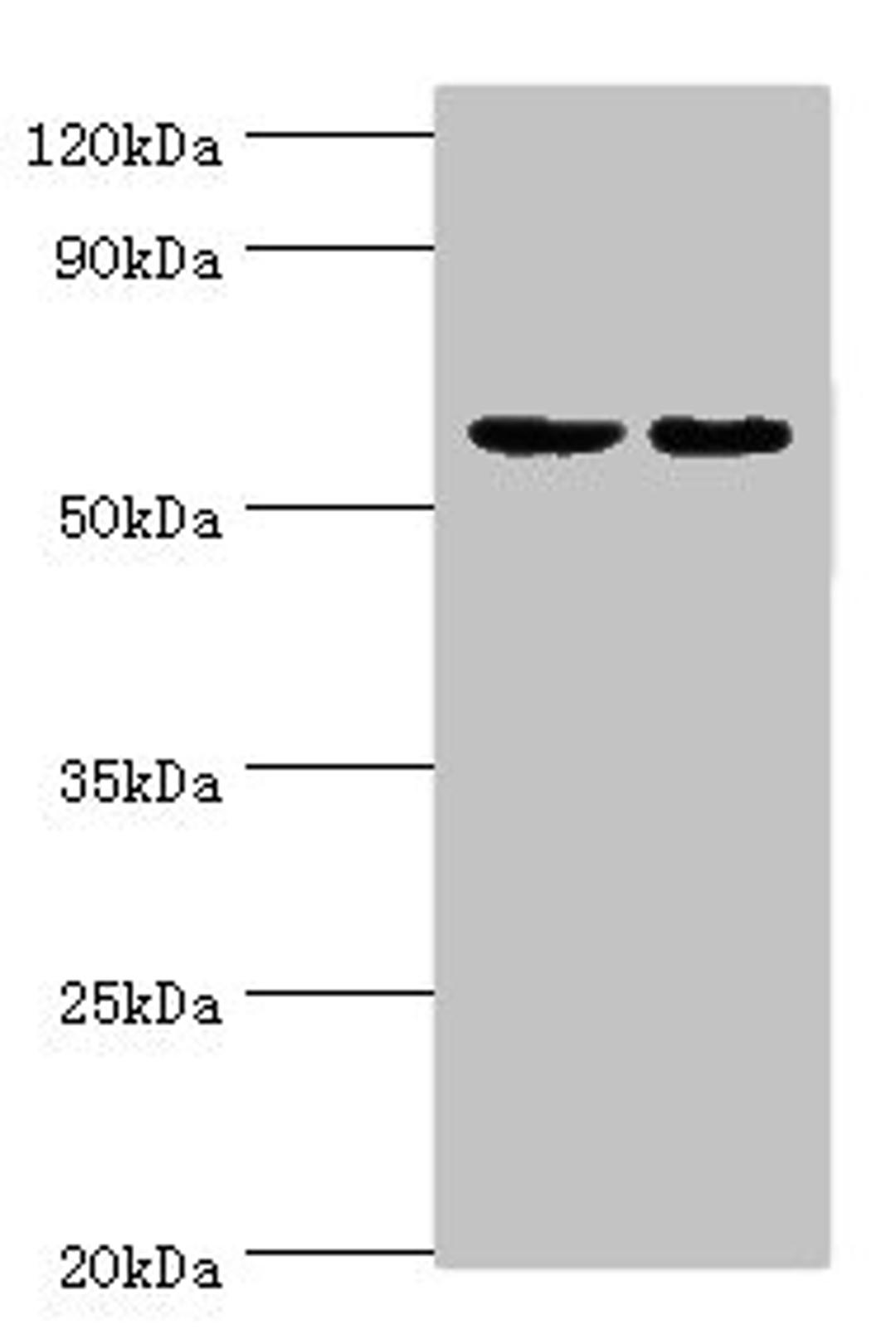 Western blot. All lanes: Diacylglycerol kinase epsilon antibody at 5ug/ml. Lane 1: Rat brain tissue. Lane 2: Hela whole cell lysate. Secondary. Goat polyclonal to rabbit IgG at 1/10000 dilution. Predicted band size: 64, 21 kDa. Observed band size: 64 kDa. 