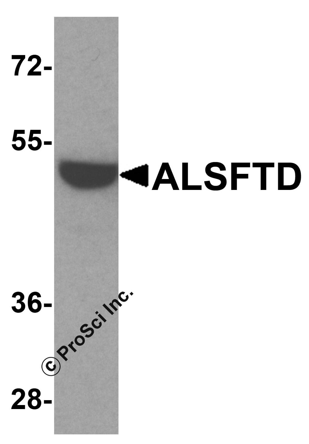 Western blot analysis of ALSFTD in HeLa cell lysate with ALSFTD antibody at 1 μg/ml.