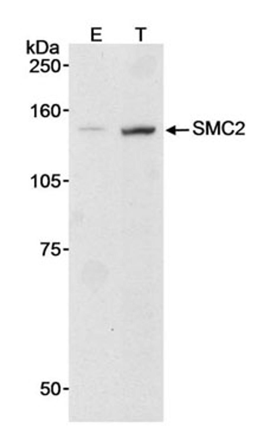 Detection of human SMC2 by western blot.