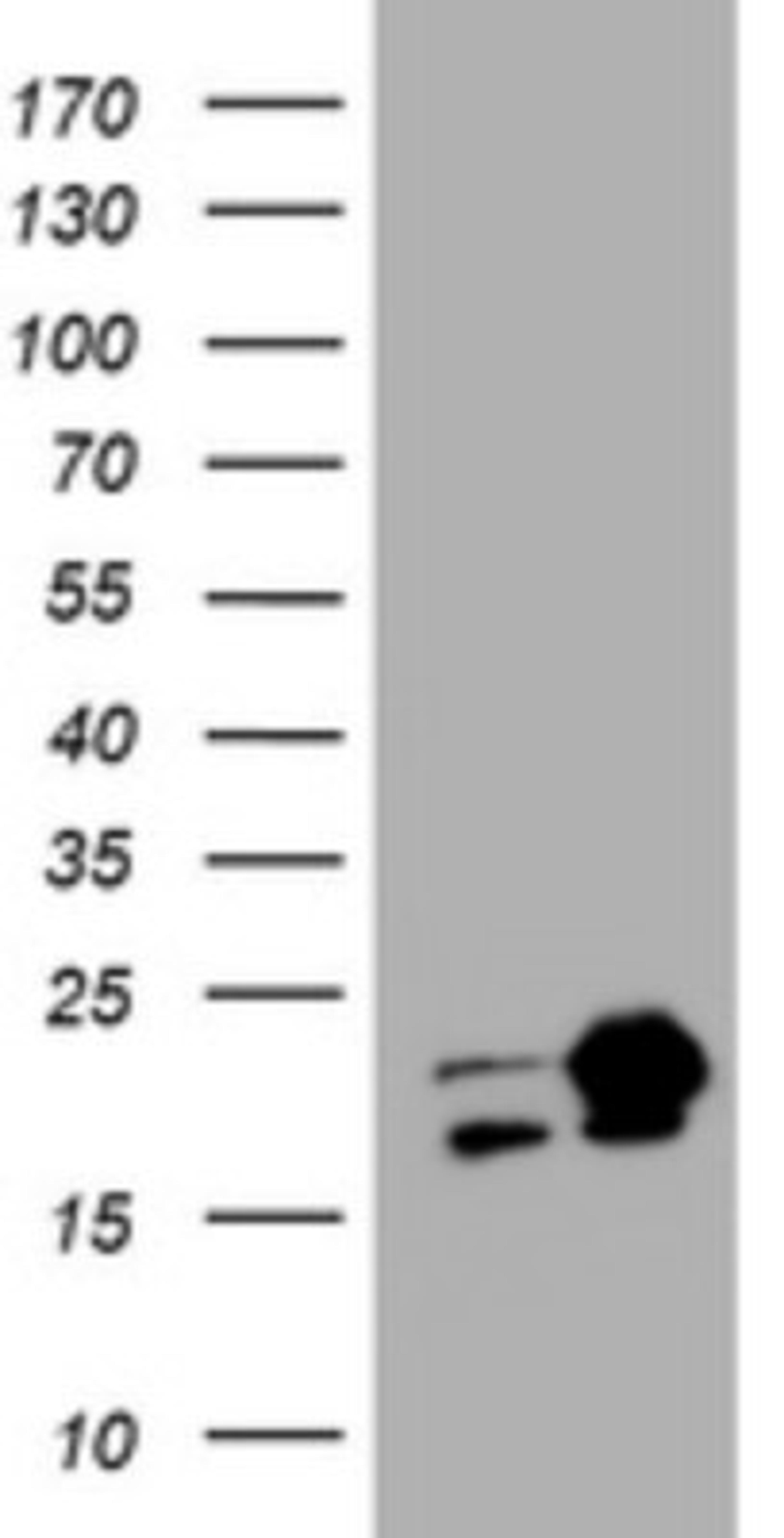 Western Blot: NM23-H1 Antibody (4H2) [NBP2-46186] - Analysis of HEK293T cells were transfected with the pCMV6-ENTRY control (Left lane) or pCMV6-ENTRY NM23-H1.