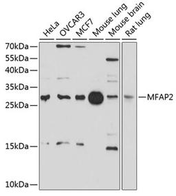 Western blot - MFAP2 antibody (A10230)