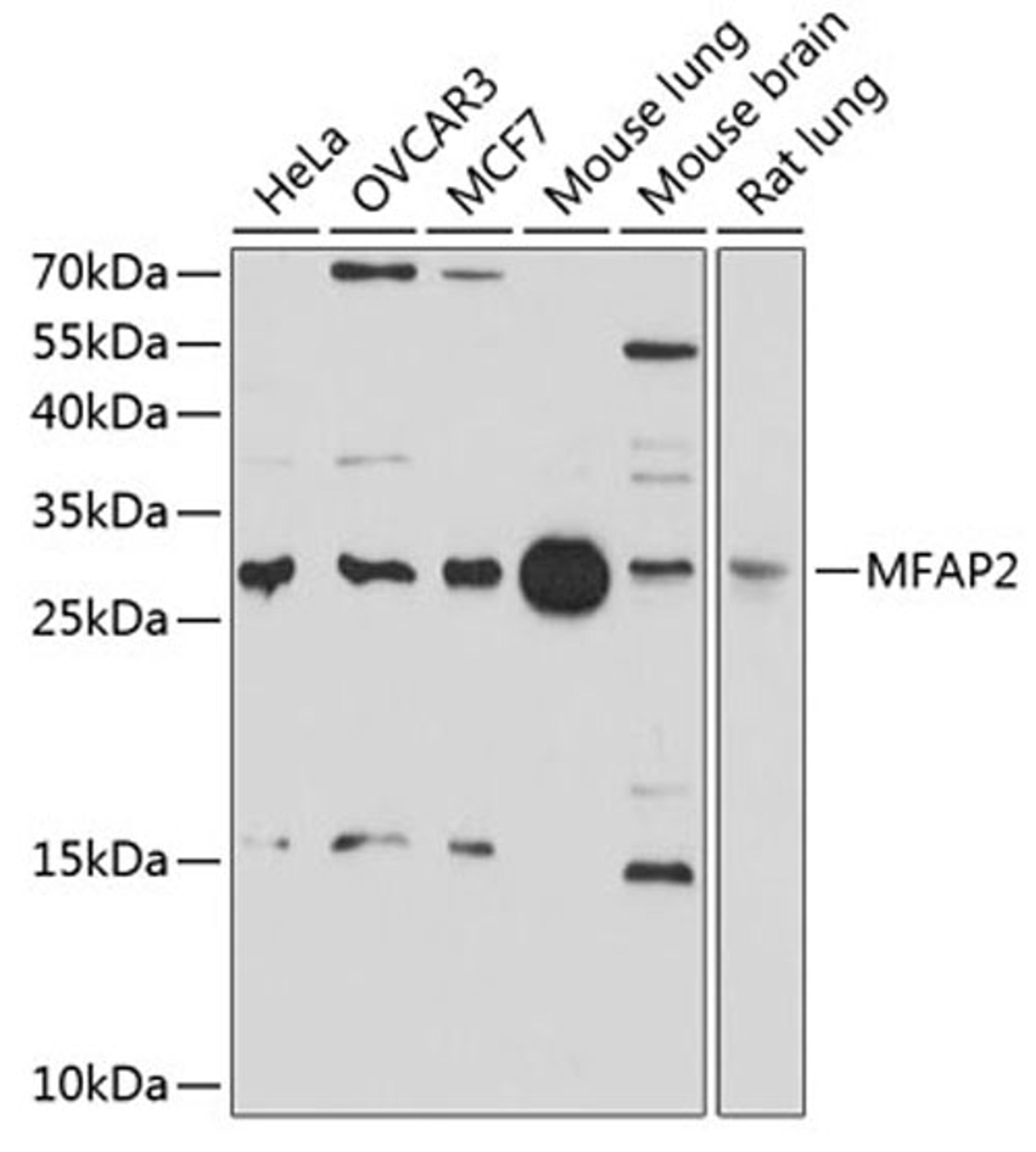 Western blot - MFAP2 antibody (A10230)