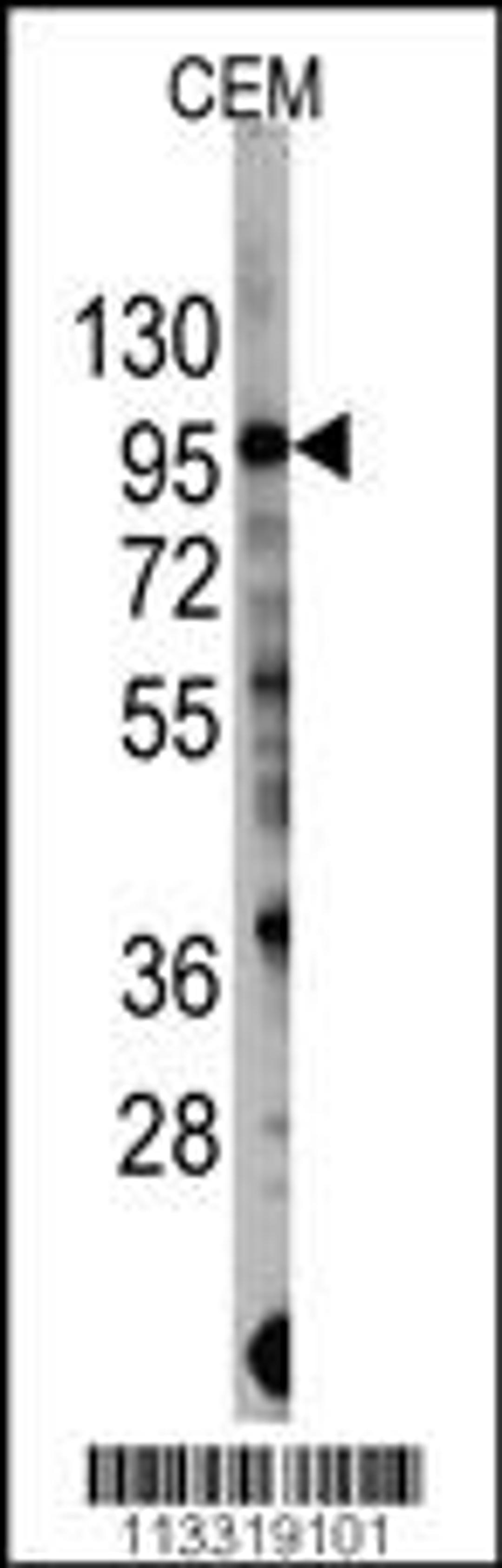 Western blot analysis of anti-PIK3CG Antibody (S1100) in CEM cell line lysates (35ug/lane).