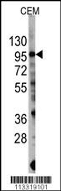 Western blot analysis of anti-PIK3CG Antibody (S1100) in CEM cell line lysates (35ug/lane).