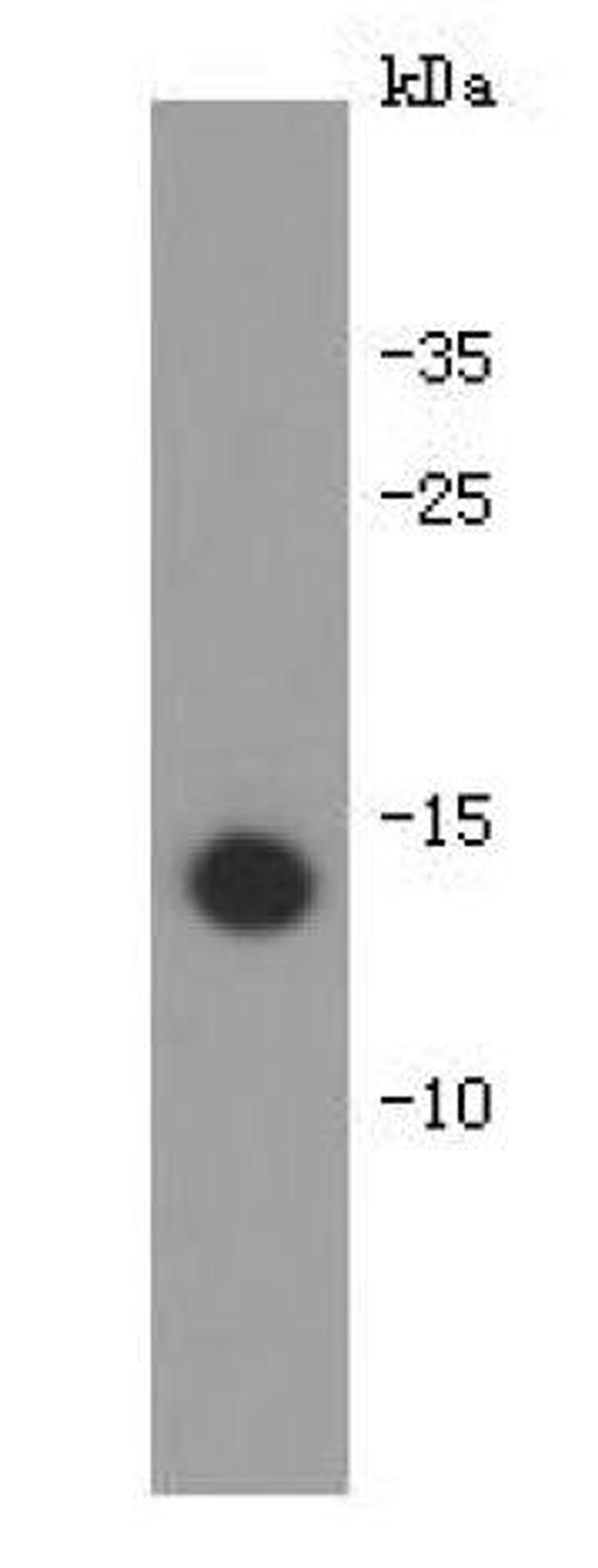 Western blot analysis of recombinant human IL-31 protein using Interleukin -31 antibody