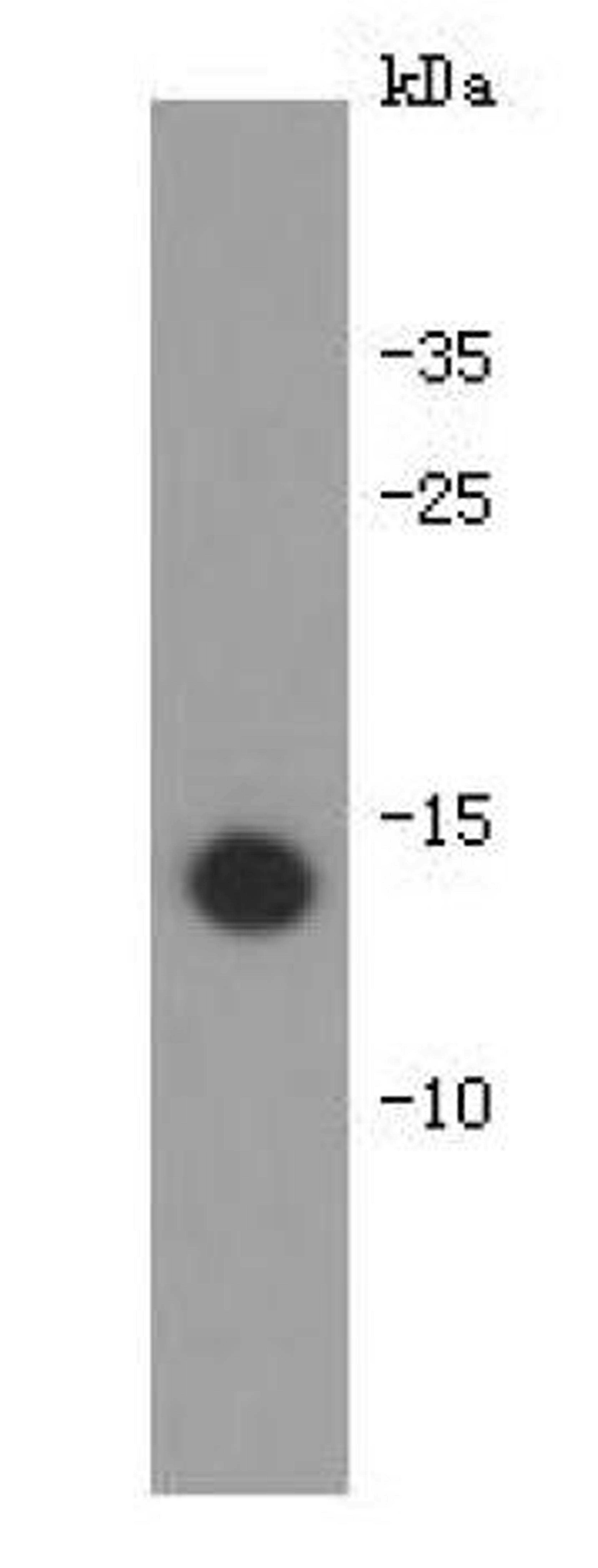 Western blot analysis of recombinant human IL-31 protein using Interleukin -31 antibody