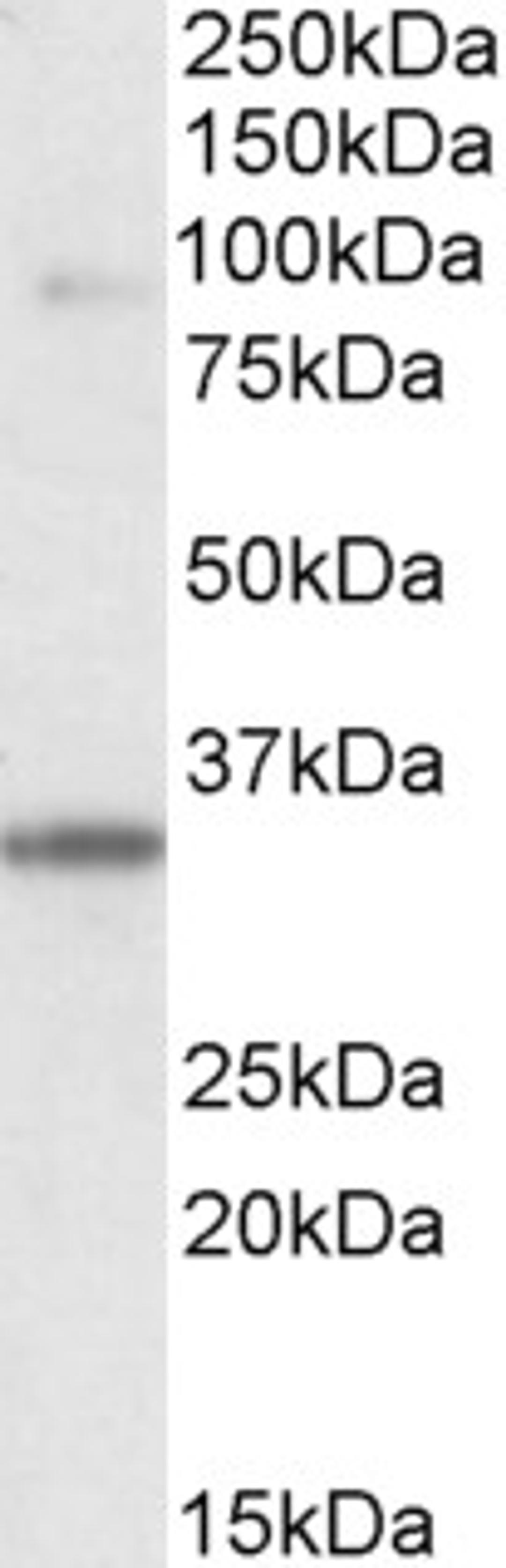 46-608 (0.1ug/ml) staining of Human Skeletal Muscle lysate (35ug protein in RIPA buffer). Primary incubation was 1 hour. Detected by chemiluminescence.