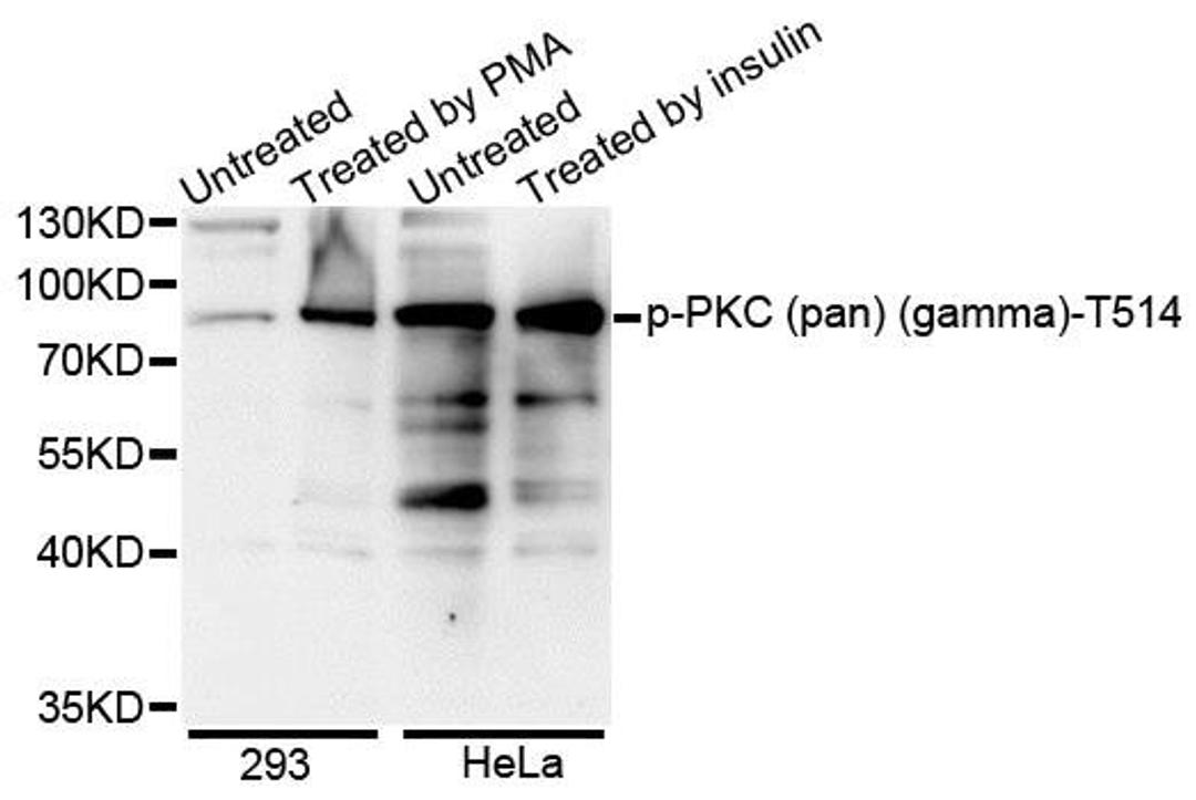 Western blot analysis of extracts of various cell lines using PKC (pan) (gamma) (Phospho-T514) antibody