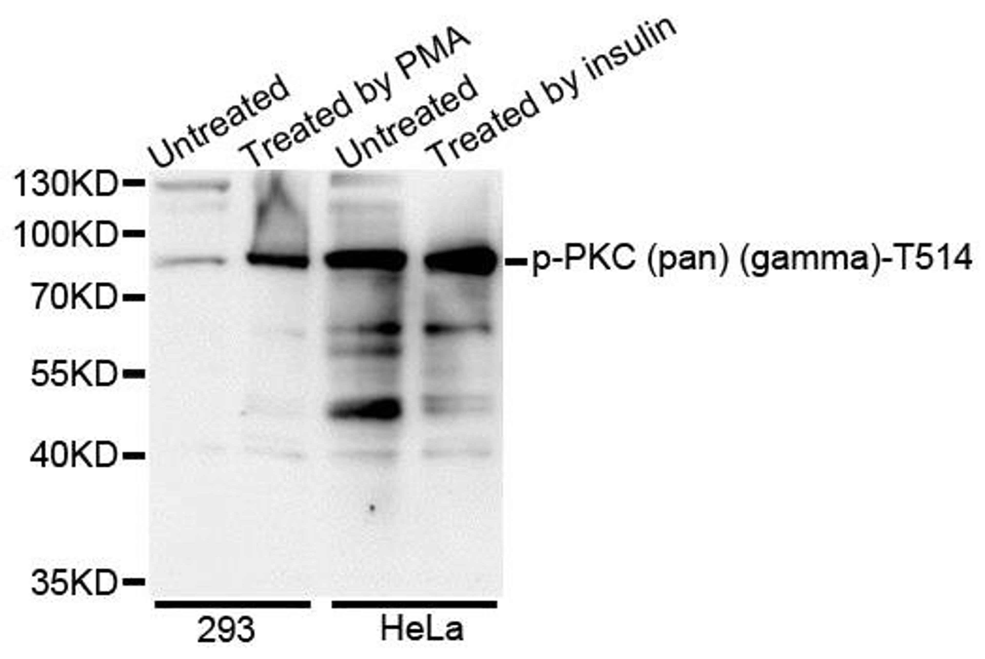 Western blot analysis of extracts of various cell lines using PKC (pan) (gamma) (Phospho-T514) antibody