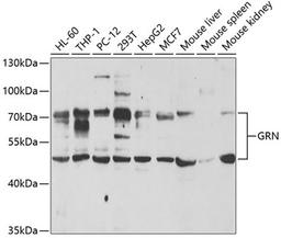 Western blot - GRN antibody (A5773)