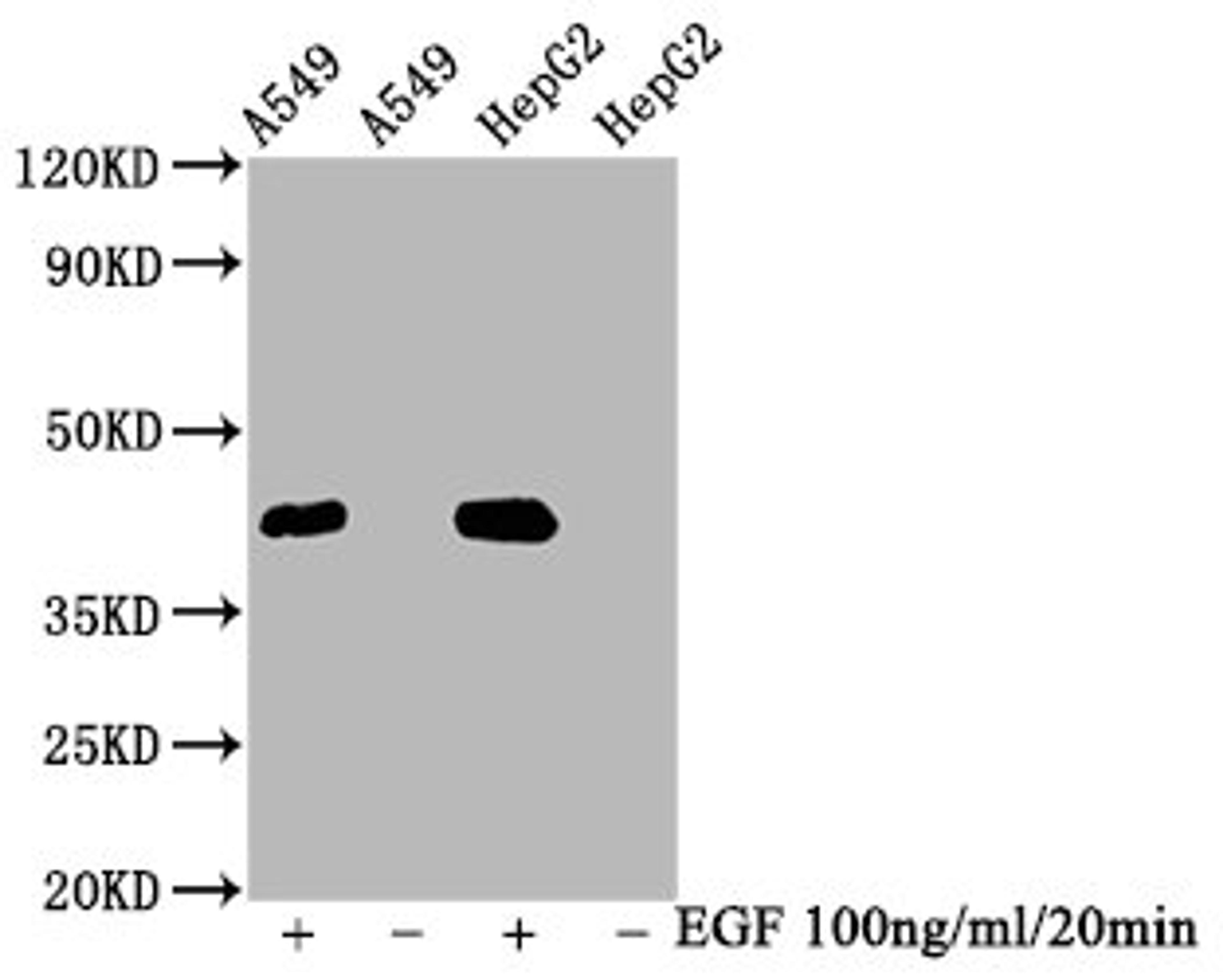 Western Blot. Positive WB detected in A549 whole cell lysate,HepG2 whole cell lysate(treated with EGF or not). All lanes Phospho-MAPK3 antibody at 2.35μg/ml. Secondary. Goat polyclonal to rabbit IgG at 1/50000 dilution. Predicted band size: 42 KDa. Observed band size: 42 KDa. 