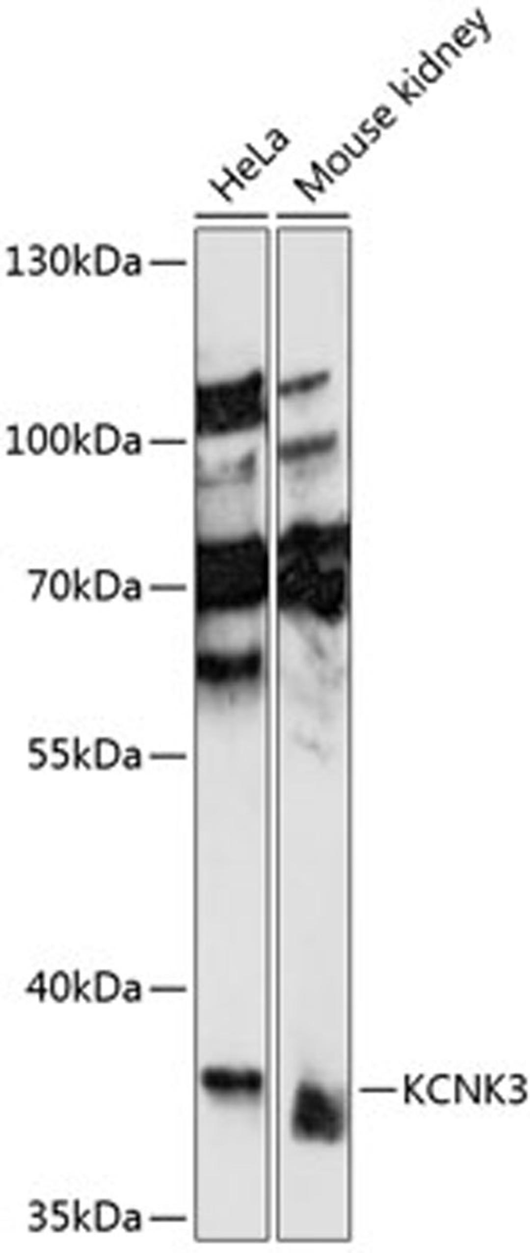 Western blot - KCNK3 antibody (A14745)