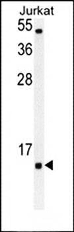 Western blot analysis of Jurkat cell line lysates (35ug/lane) using SOD1 antibody