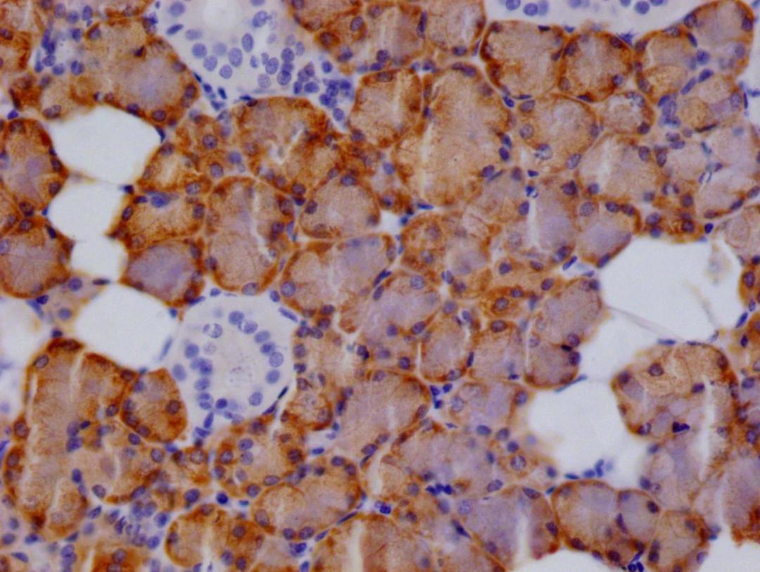 IHC image of CSB-RA548305A0HU diluted at 1:100 and staining in paraffin-embedded human salivary gland tissue  performed on a Leica BondTM system. After dewaxing and hydration, antigen retrieval was mediated by high pressure in a citrate buffer (pH 6.0). Section was blocked with 10% normal goat serum 30min at RT. Then primary antibody (1% BSA) was incubated at 4°C overnight. The primary is detected by a Goat anti-rabbit polymer IgG labeled by HRP and visualized using 0.05% DAB.